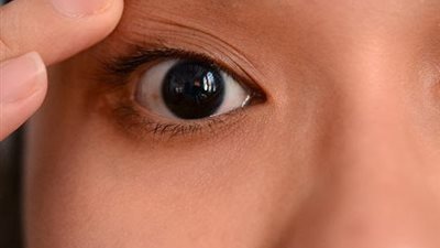 8 علاجات منزلية لـ«جفاف العين»