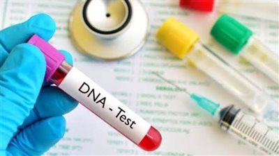 تحليل DNA يثبت نسب طفلين توءم لطبيب وسيدة تركت طفليهما في حضانة بأوسيم