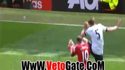 بالفيديو.. إصابة نجم «مان يونايتد» أثناء لقاء «توتنهام»