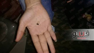 نشطاء يتداولون صورة لأحدث سماعة بلوتوث للغش في الثانوية العامة