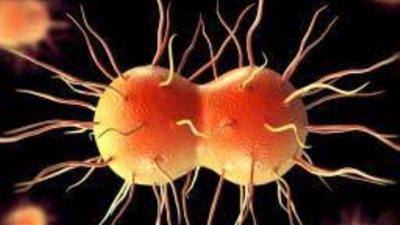 10 معلومات عن مرض السيلان للرجل والمرأة