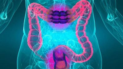 طرق الكشف المبكر عن سرطان القولون