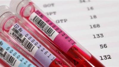 أسباب سرعة الترسيب فى الدم للأطفال والكبار