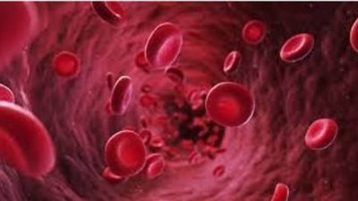 10 أعراض تظهر على مريض الثلاسيميا.. تعرف عليها