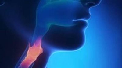 4 نصائح للتغلب على ارتجاع المريء