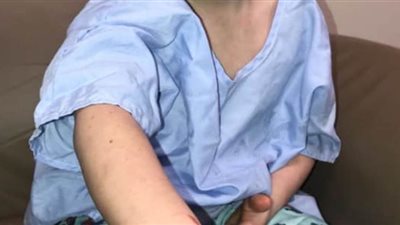 طفل عمره 5 سنوات ينقذ 7 أشخاص وكلبا من الاحتراق