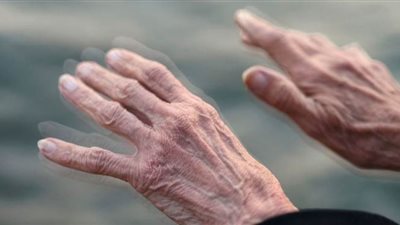 5 تحديات تواجه مرضى الشلل الرعاش في مصر