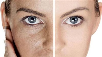 5 وصفات من مطبخك لعلاج المسام الواسعة