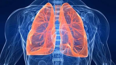 أعراض وأسباب الالتهاب الرئوي