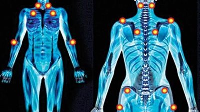 كل ما تريد معرفته عن مرض الفيبروميالجيا