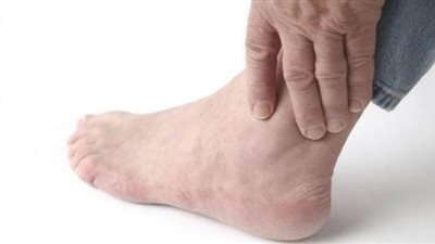 الماء والأسماك.. أفضل العلاجات الطبيعية لمرض النقرس