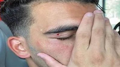 شوبير يوضح حقيقة إصابة 