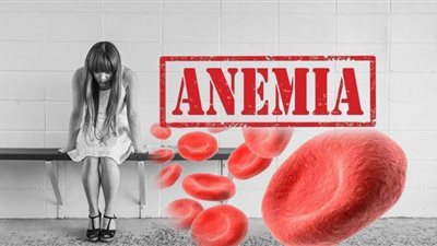 أعراض الأنيميا وطرق العلاج
