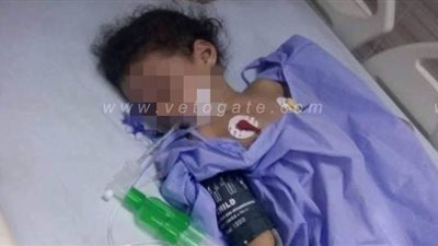 وفاة الطفلة ضحية إهمال والدتها بالقليوبية