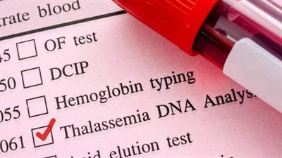 تعرف على أعراض مرض أنيميا البحر المتوسط وطرق الوقاية