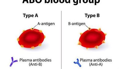 دراسة تكشف أن حاملي فصيلة A أكثر عرضة للإصابة بكوفيد 19