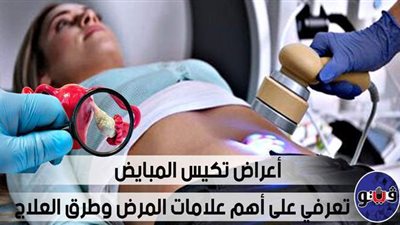أعراض تكيس المبايض.. تعرفي على أهم علامات المرض وطرق العلاج | فيديو