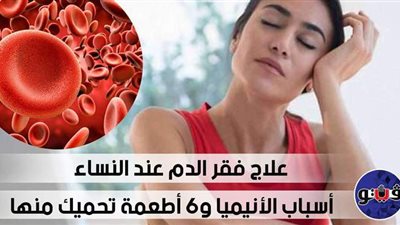 علاج فقر الدم عند النساء.. أسباب الأنيميا و6 أطعمة تحميك منها (فيديو)