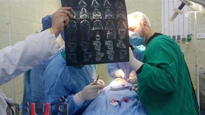 جراحة دقيقة بالوجه بمستشفى فاقوس في الشرقية