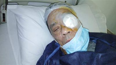 تفاصيل الحالة الصحية لحلمي بكر بعد إجرائه عملية جراحية بالعين