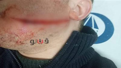 بائع متجول يعتدى على صاحب مطعم شهير في المحلة بمطواة