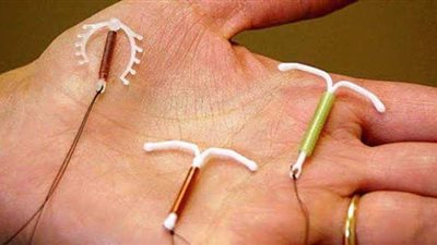 هل يسبب استخدام اللولب نزيفا للسيدة؟