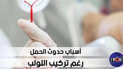 أسباب حدوث الحمل رغم تركيب اللولب | فيديو
