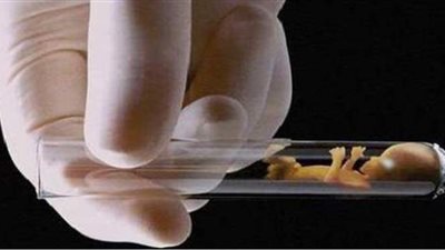 ما حكم الشرع في الإنجاب عن طريق أطفال الأنابيب؟.. دار الإفتاء تجيب