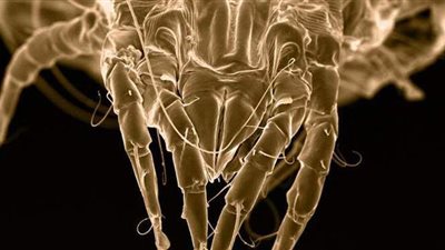 تشبه العناكب.. حشرات تعشش في البشرة وتضع بيضها في مسام الجلد