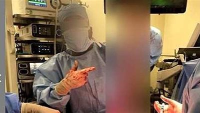 كانوا بيلعبوا.. أطباء نساء وتوليد يعبثون بأعضاء مريض بغرفة العمليات | فيديو