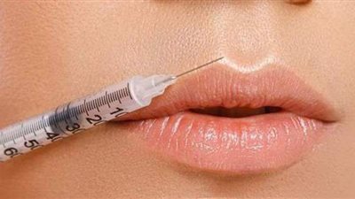 نشرة الحوادث.. وأبرزها: فتاة تتهم طبيبة بتشويهها والتسبب في إصابتها بغرغرينا.. والتقرير الطبي الخاص بفتاة المعادي المسحولة