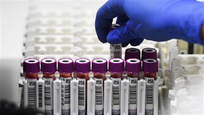 الكشف عن سبب مفاجئ للإصابة بالسكري والخرف والسرطان