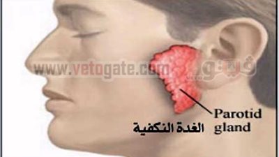 أسيوط تقضي على الجديري المائي وتحاصر النكافية