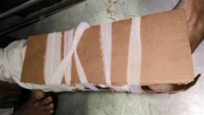 تفاصيل تركيب جبيرة كرتون لمريض بمستشفى سيوة