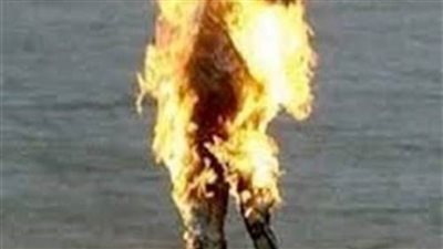 الاستعلام عن حالة ترزي اشتعلت النار في جسده بأطفيح