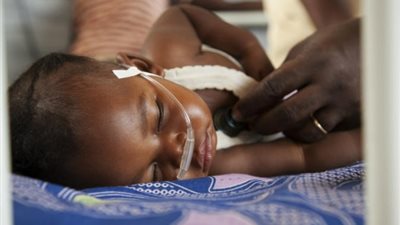 «الحصبة» تقتل 315 شخصا و20 ألف مصاب في «الكونغو الديمقراطية»