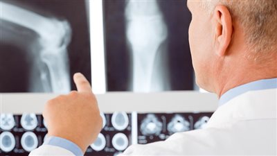 استشاري عظام يوضح طرق علاج كسور الحوض