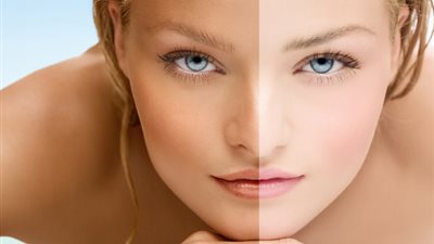 خلطة طبيعية تخلصك من اسمرار البشرة طوال الصيف