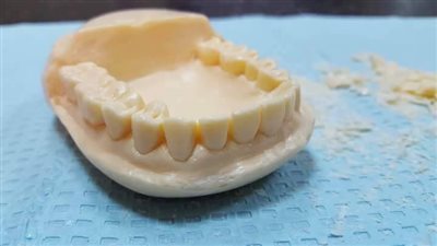 بالصور.. طبيب يحول قطعة صابون إلى «طقم أسنان» بطريقة مدهشة