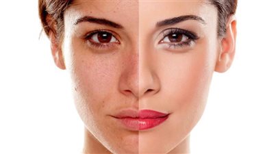 3 وصفات طبيعية وغير مكلفة لتفتيح البشرة