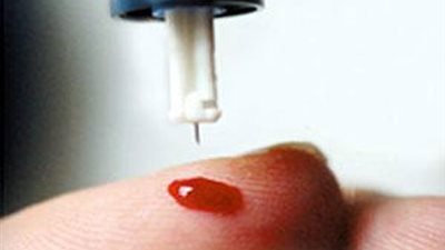 اختبار للدم لتحديد مدى استجابة الأورام السرطانية للعلاج