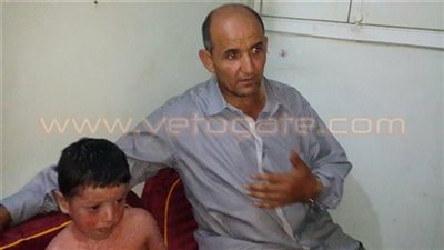 مأساة طفل بالدقهلية مصاب بمرض نادر في الجلد.. «محمد» لا يوجد له علاج في مصر.. الأطباء ينصحون بسفره للندن.. والدته: «مبقاش حيلتى حاجة.. ومستعدة أبيع هدومى وأعالجه».. ومطالبات بتدخل 