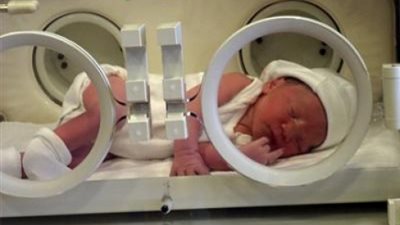 هرمون الإريثروبويتين يحمي الأطفال المبتسرين من إصابات المخ