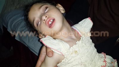 بالفيديو والصور.. مأساة طفلة مصابة بضمور في المخ بالدقهلية.. والدة «بسملة»: «نفسي أسمع منها كلمة ماما.. أمل حياتي أشوفها بتلعب زي باقي الأطفال».. والأطباء: الحل الوحيد في سفرها للع
