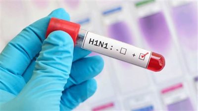 عودة انفلونزا الخنازير.. الأعراض والعلاج وطرق الوقاية