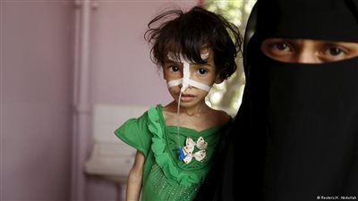 «اليونيسيف»: مقتل 398 طفلا في اليمن خلال 6 أشهر