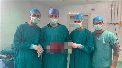 نجاح استئصال ورم يزن 8 كيلو من بطن طفلة بأسيوط | صور