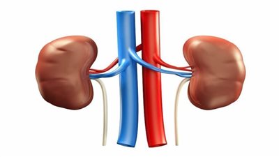 أسباب تكون حصوات الكلى