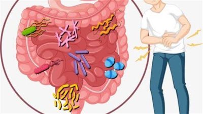 علاج جرثومة المعدة | احذر أعراض الإصابة بجرثومة المعدة