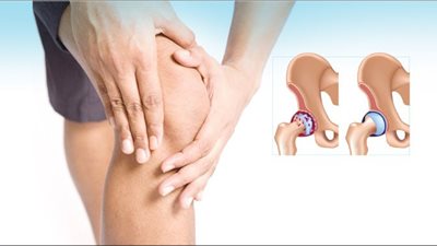 التطورات الصحية لالتهاب المفاصل الروماتيزمي